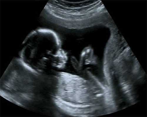 胎教很重要，请代怀孕的妈妈们一定要注重胎教