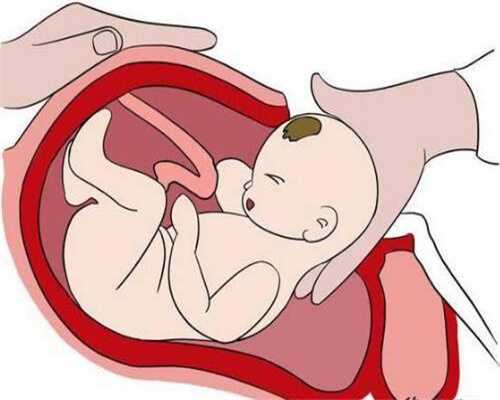 宫外孕会在第四周时出血吗代孕阴道出血说明什