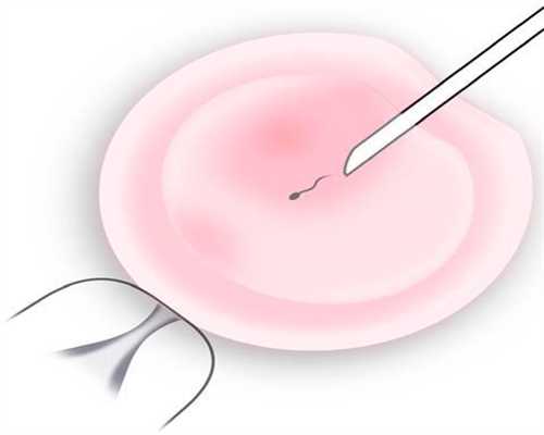 6个月脐带扭转导致胎停，是什么原因下次怀孕需