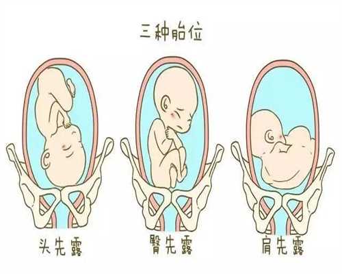 杭州助孕产子,怀孕后，孕妇的子宫会增大多少那