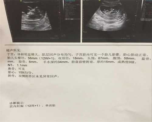 北京神州中泰,怀孕期间老公车祸去世，小叔发来