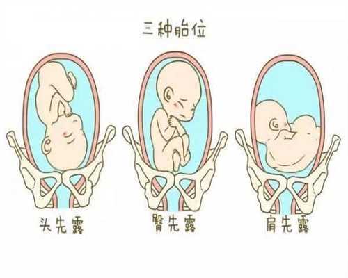 糜蛋白酶助孕,孕期你是怎么睡的呢3张图带你看完