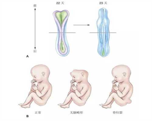 代孕在美国合法吗,怀孕7周胎儿长什么样子了，孕