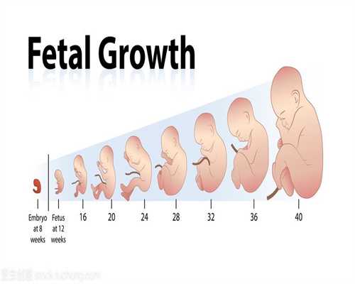 代怀孕价格,怀孕期间，为了让胎宝宝远离脐带绕
